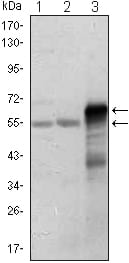 Figure 1: Western blot analysis using ETS1 mouse mAb against Jurkat (1), HepG2 (2) and ETS1-hIgGFc transfected HEK293 (3) cell lysate.