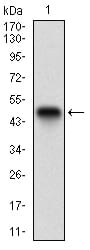 Figure 1: Western blot analysis using CK5 mAb against human CK5 recombinant protein. (Expected MW is 47.8 kDa)