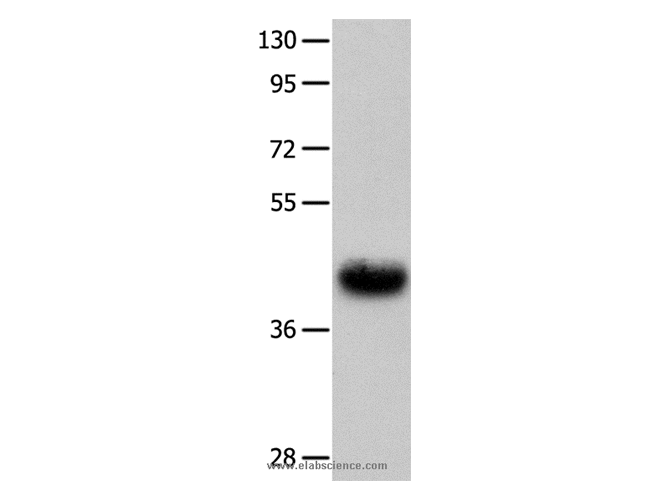 UTS2R Polyclonal Antibody